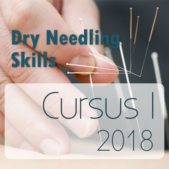 Dryneedling cursus 1-2018, Dryneedlingskills, Utrecht