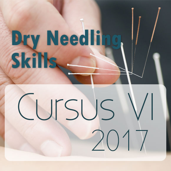 Dryneedling cursus 6-2017, Utrecht